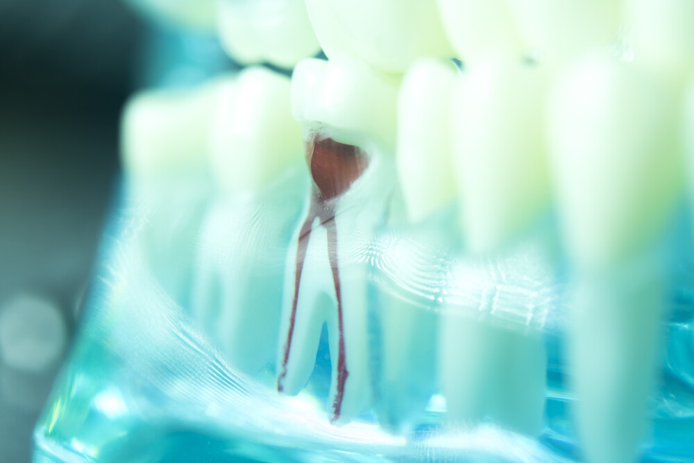 dental tooth root canal dentists teeth model closeup