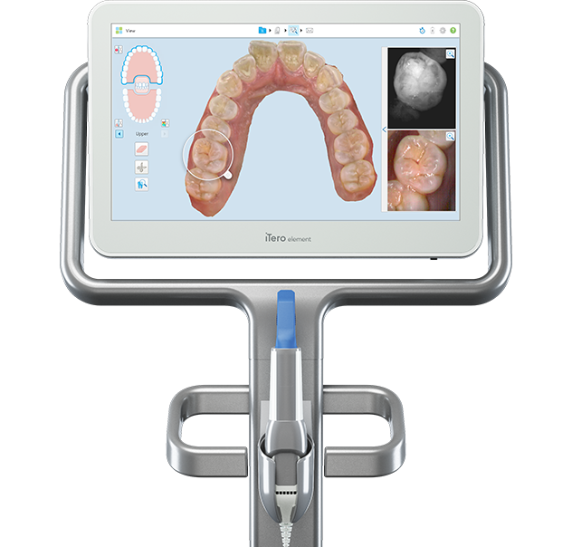 iTero Element 5D imaging system intraoral scanner interproximal caries detection digital impressions treatment simulation diagnostic monitoring tooth structure visualizing restorative dentistry treatments