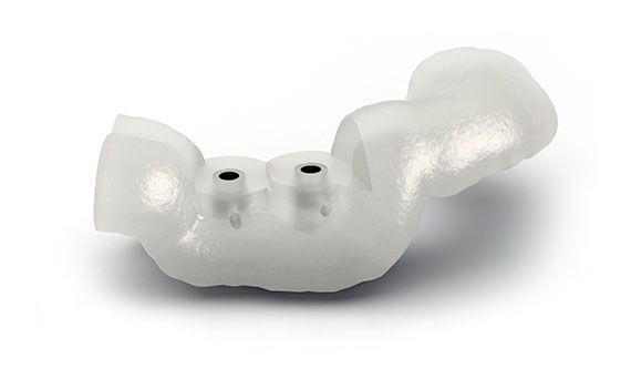 Simplant guided dental implant surgery 3D digital restorative treatment stereolithographic flexible bone-supported seamless restoration