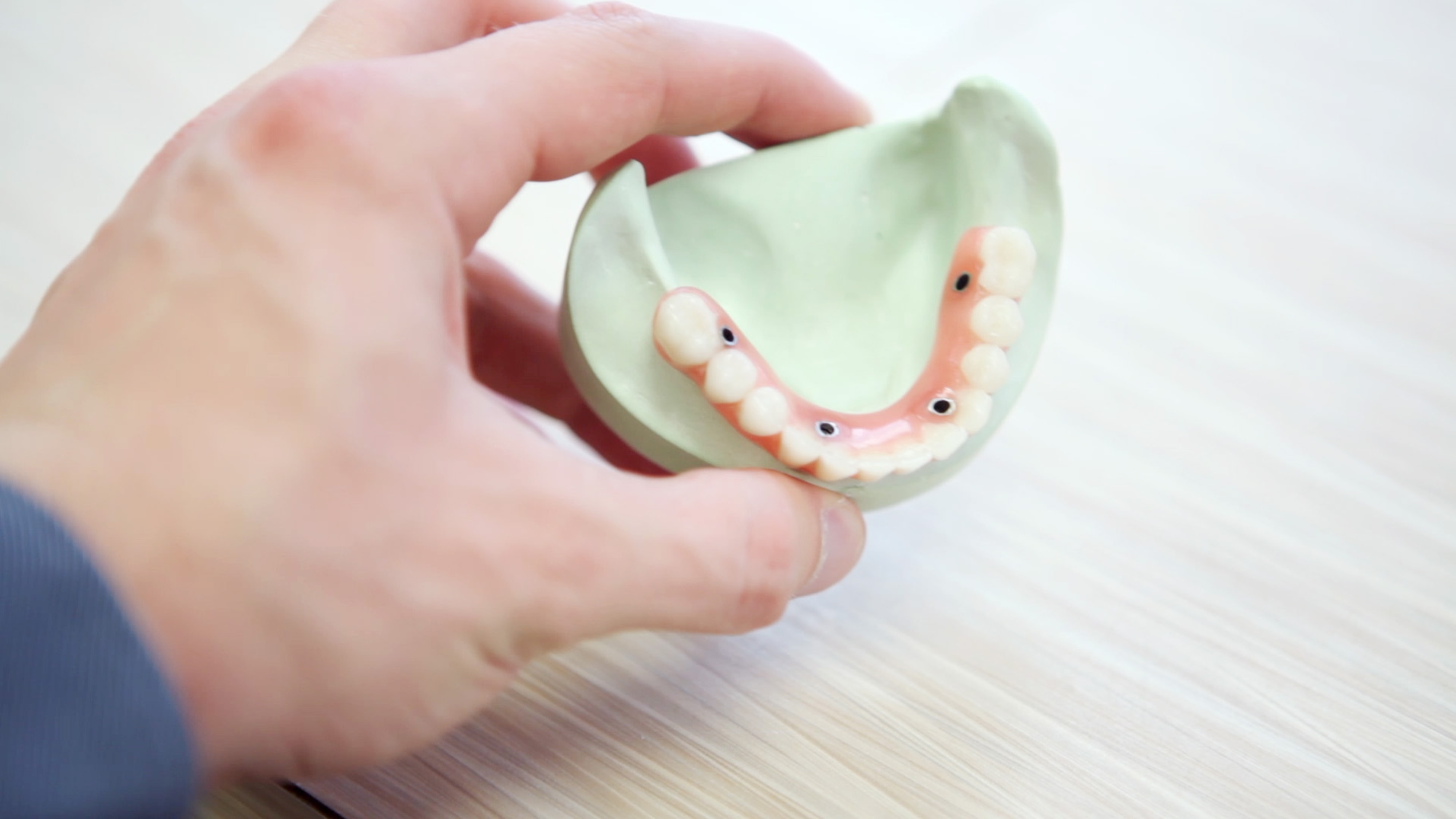 person holding teeth dental implants aesthetics hand implant acrylic bridge